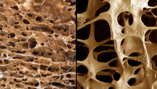 Lifestyle and eating habits too affect bone density