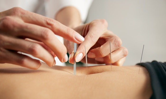 Acupuncture is not effective on all individuals