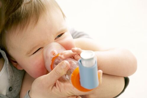 Folate supplements pave way for asthma in infants
