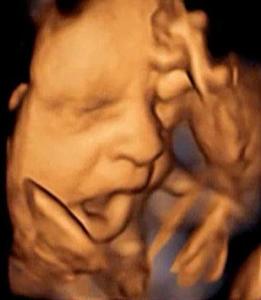 Fetuses above 20 weeks yawn inside the womb