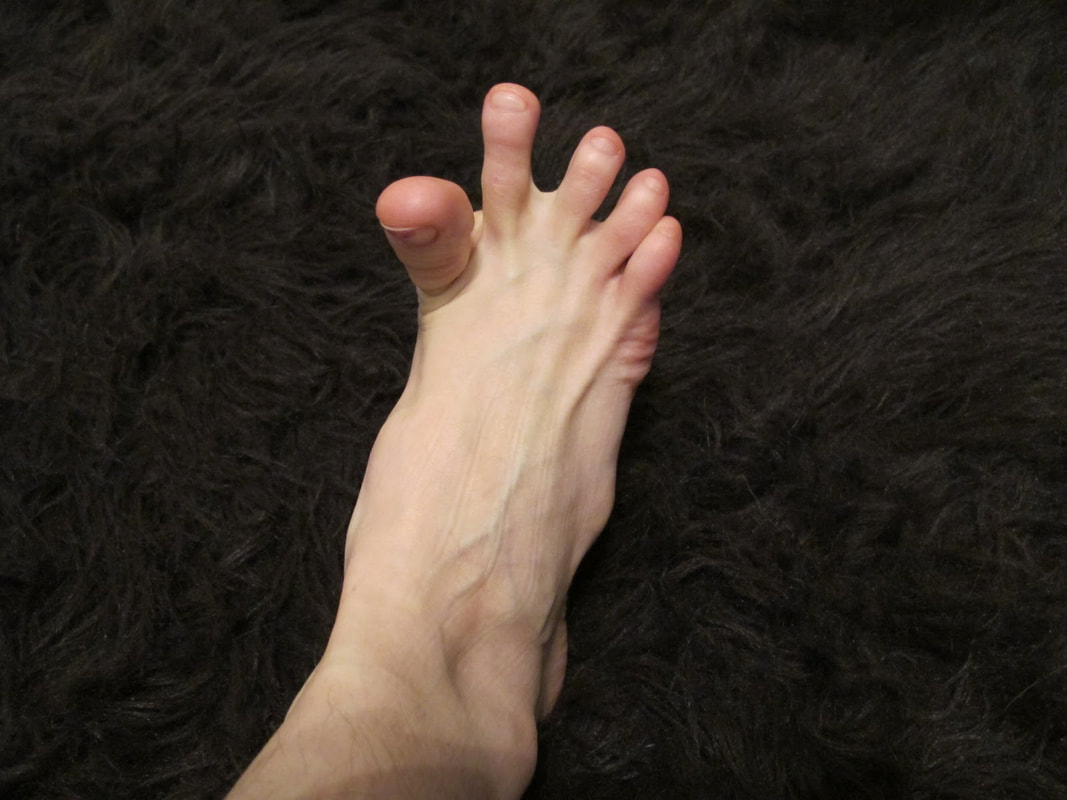 Dehydration and uneven blood flow can cause toe cramps